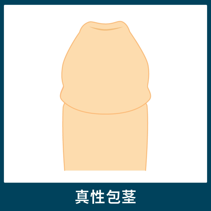 真性包茎の陰茎（ペニス）